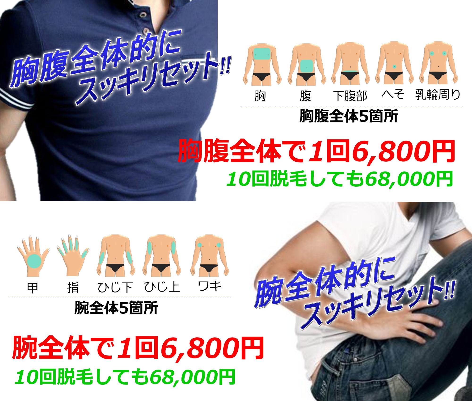 おすすめセット脱毛